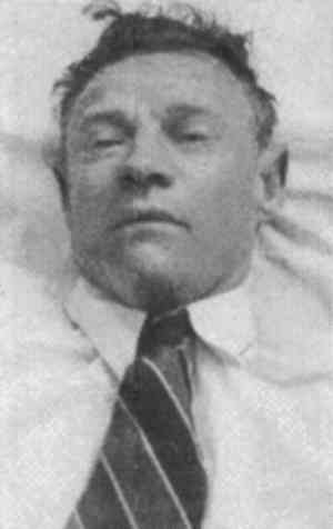Imagen: Fotografía del cadáver, tomada por la policía australiana. Wikimedia Commons